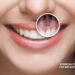 Implant Esthetic Excellence